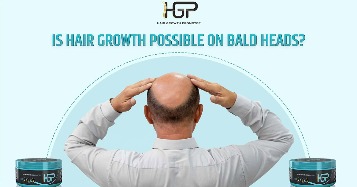 Is Hair Growth Possible on Bald Heads
